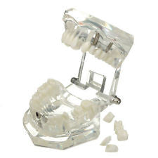 Dental Teeth Model Study Teaching Implant Restoration Bridge Tooth Brackets