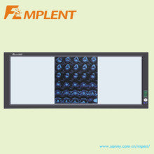 three panels led radiographic film viewer for hospital